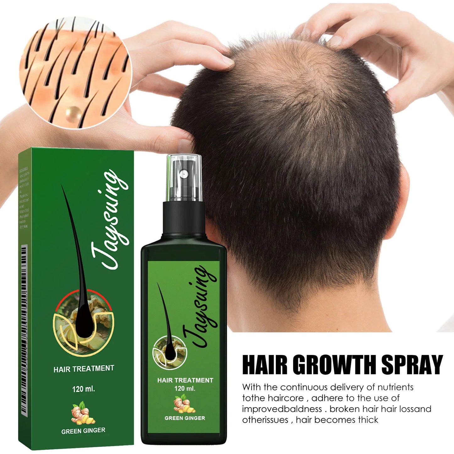 Spray de jengibre para el crecimiento del cabello: tratamiento reparador y estimulante
