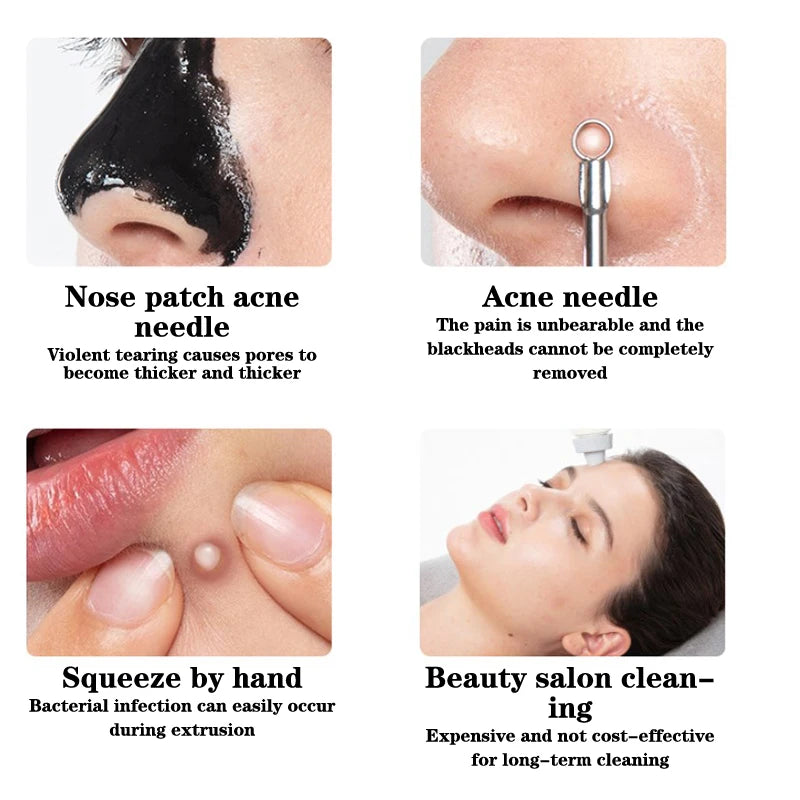 ✨ Espátula Limpiadora Facial – Exfoliante y Extractor de Puntos Negros